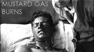 Chemical Weapons of WW1 - Horrific Weapons of War - No1