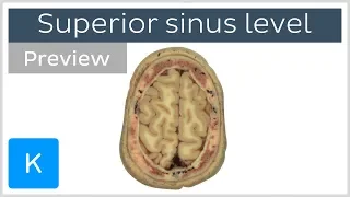 Cross sections at the superior sagittal sinus level (preview) - Human Anatomy | Kenhub