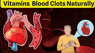 Potent Vitamins to Naturally Dissolve Blood Clots - Unlocking the Power of Health