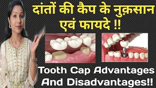 दांतों की कैप के फायदे एवं नुकसान |कैप लगवाएं या नहीं? |Teeth Cap Advantages & Disadvantages