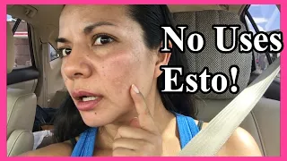 Me Quemó la Piel! 😭 | Crema Aclaradora Para Manchas 😱 | Sara Pelucas 💖