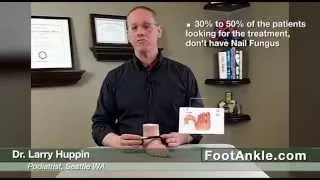 Laser Toenail Treatment -- Why You Should NEVER Use Online Coupons by Seattle Podiatrist Dr. Huppin