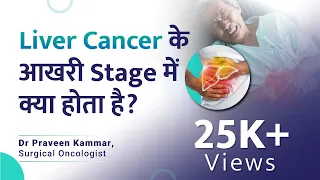 Liver Cancer के आखरी stage में क्या होता है? |Challenges in Stage 4 Liver Cancer | Dr Praveen kammar