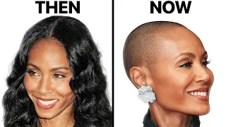 Jada Pinkett Smith | Women's Hair Loss Explained