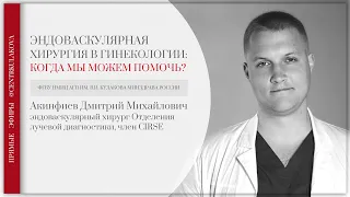 ЭМБОЛИЗАЦИЯ МАТОЧНЫХ АРТЕРИЙ ПРИ МИОМЕ МАТКИ