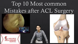 Top 10 Most Common  Mistakes After ACL Surgery.