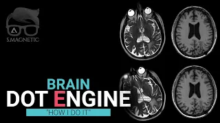 Brain Dot Engine – “How I Do It”