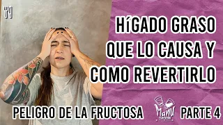 🤯QUÉ CAUSA EL HIGADO GRASO Y CÓMO REVERTIRLO | CÓDIGO DE LA DIABETES PARTE 4 | Manu Echeverri