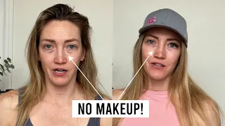 How to Reduce the Appearance of Dark Under Eye Circles Without Makeup!