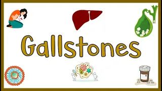 Gallstones - Causes, Pathogenesis, Signs & Symptoms, Complications, Diagnosis & Treatment