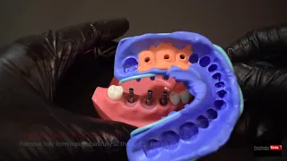 Impression Techniques for Implant Dentistry -  | step by step | Closed tray Impression technique