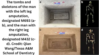 Remains of two men from central China shed light on ancient practice of punitive amputation