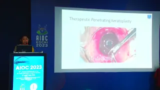 AIOC 2023   IC10   topic Dr SHWETA AGARWAL Therapeutic penetrating keratoplasty with  without surgic