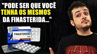 FINASTERIDA TÓPICA PARA TRATAR CALVÍCIE MASCULINA!