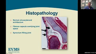 Endotracheal tube injury and Posterior glottic stenosis - Dr. John Sinacori