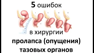 Путь к осложнениям в хирургии при пролапсе  (опущении) тазовых органов у женщин