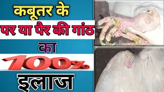 Kabootar ke par ya per me ganth ka ilaj | कबूतर के पर या पैर की गांठ का इलाज