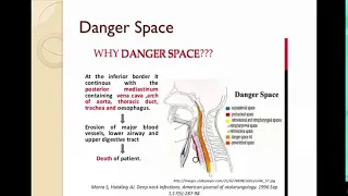 Deep Neck Infections