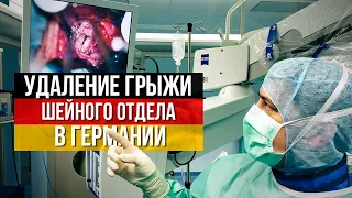 Удаление грыжи, эндопротезирование дисков шейного отдела в Германии