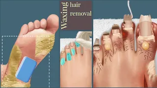 MARIA TREATMENT .WAXING HAIR REMOVAL .ACNE REMOVAL.ASMR MAKEOVER GAME . #viral