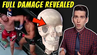 Jiri Prochazka Elbow FULL DAMAGE vs Dominick Reyes - Doctor Explains UFC Injury