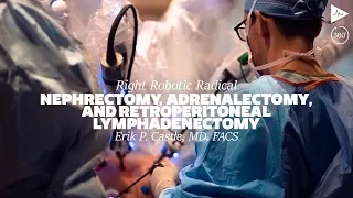 Nephrectomy, Adrenalectomy & Retroperitoneal Lymphadenectomy by Eric P. Castle, MD | Full Case