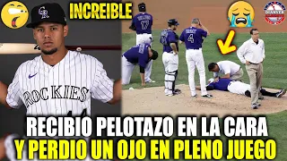 Este PELOTERO Recibe PELOTAZO en la CARA y PIERDE un OJO en PLENO JUEGO NO CREERAS LO QUE PASO MLB