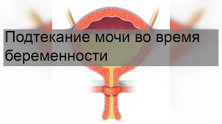 Подтекание мочи во время беременности