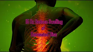 15 Hz Reduce Swelling of Herneated Disc - Healing Isochronic Binaural Beats | 15 Min Rife Treatment