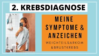 2. Krebsdiagnose: meine Symptome und Anzeichen | Weichteilsarkom & Brustkrebs