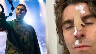 Liam Gallagher 'Falls out of helicopter after the Isle of Wight Festival performance