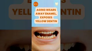 Why Are My Teeth Yellow? Common Causes and Solutions!
