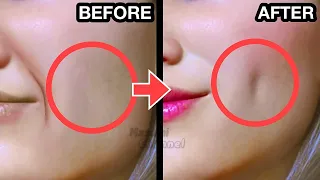 25MINS🔥 How To Get DIMPLES Fast & Naturally! Simple Facial Exercises to get Dimples without Surgery