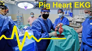 The Surprise EKG Readings from the World's First Pig Heart Transplant