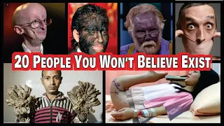 20 PEOPLE YOU WON'T BELIEVE ACTUALLY EXIST AROUND THE WORLD-The UNUSUAL People you never seen before