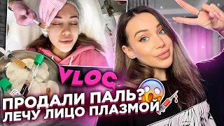 Продали паль?!😱Лечу лицо плазмой💉VLOG