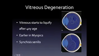 Retinal Detachment Lecture for Phase 5 Ophthalmology by Şengül Özdek