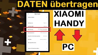 Xiaomi Daten übertragen