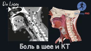 Боль в шее / компьютерная томография шеи