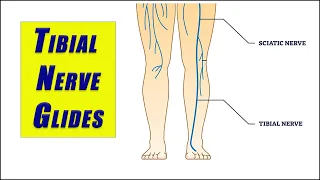 Flossing Exercises for TIBIAL NERVE ENTRAPMENT and TARSAL TUNNEL SYNDROME
