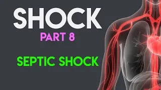 Septic Shock | Shock (Part 8)