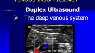 Lower Extremity Venous Duplex Ultrasound Chronic Venous Insufficiency