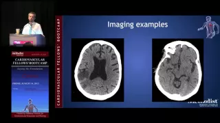 Diagnosis and Medical Management of Stroke (John J. Volpi, MD)