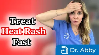 How to identify and treat heat rash fast