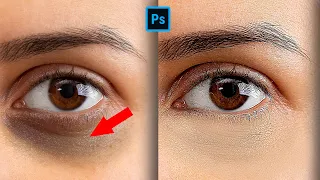 Remove Dark Circles Naturally - 1 Minute Photoshop Tutorial #shorts