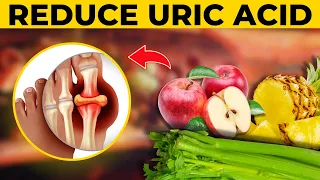 10 Best Foods to Lower High Uric Acid in the Blood