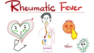 Rheumatic Fever - Jones Criteria - Causes, Signs, Symptoms, Diagnosis & Treatment - Cardiology