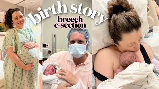 MY BIRTH STORY ... scheduled c-section for our breech baby