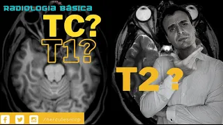 Como identificar T1, T2, FLAIR E DIFUSÃO? Não se perca entre radiografia, ressonância e tomografia!