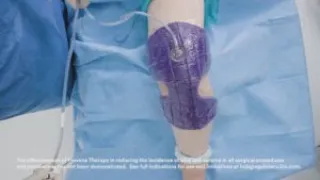 3M™ Prevena™ Therapy Tips and Tricks Video Orthopedic Knee